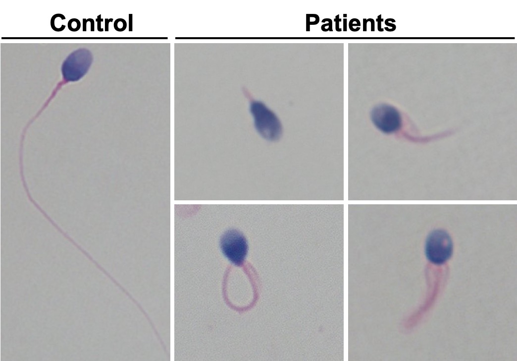 Discovery Of A Molecule That Is Essential For The Formation Of Sperm